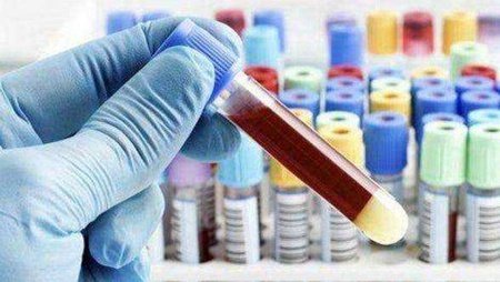 血沉偏高，这是怎么回事