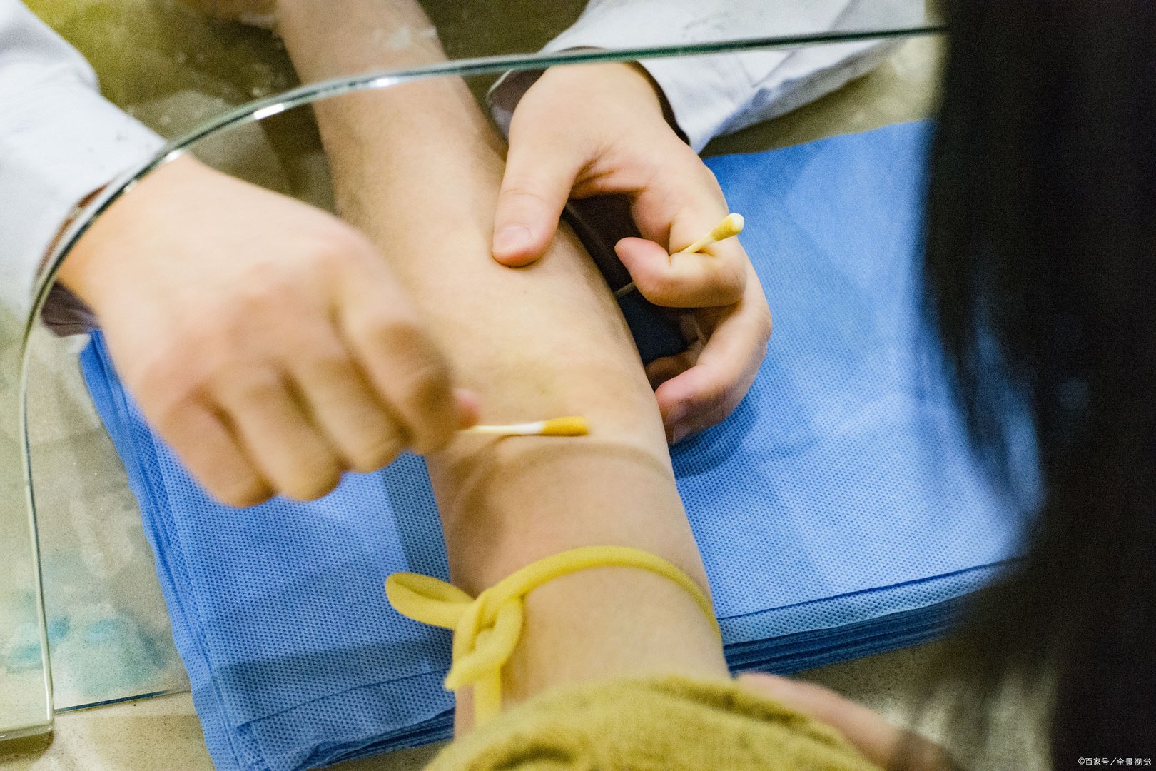 破伤风针在几个小时内打才有效