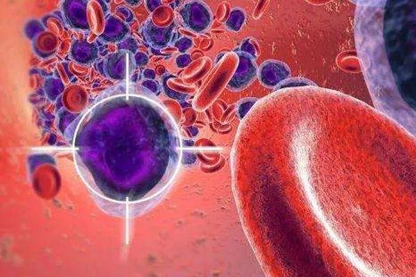 白血病能完全治愈吗?