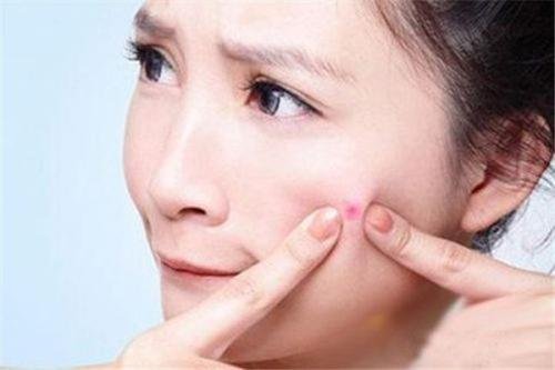 怎么去痘痘最快,用什么方法啊？