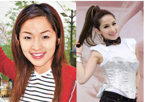 萧亚轩整容前后照片对比什么样的？