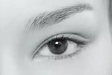 双眼皮平行和扇形的区别