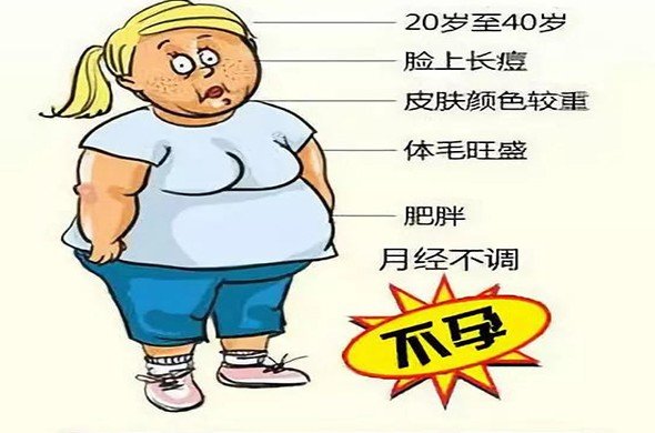 多囊卵巢综合症是什么意思