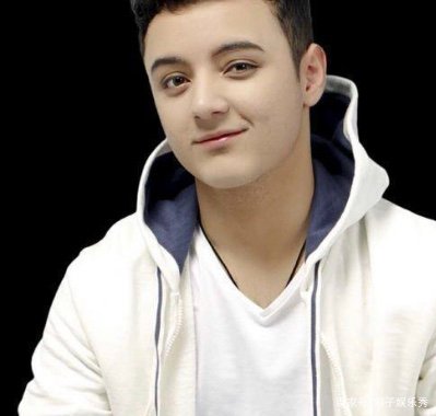 阿尔法植发仿佛“整容”，秃顶时被嫌丑，如今怎样了？