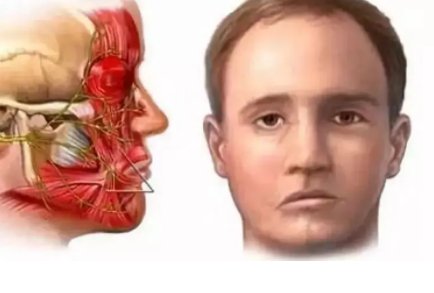 “亨特氏综合征”是什么病？这种病该如何预防？