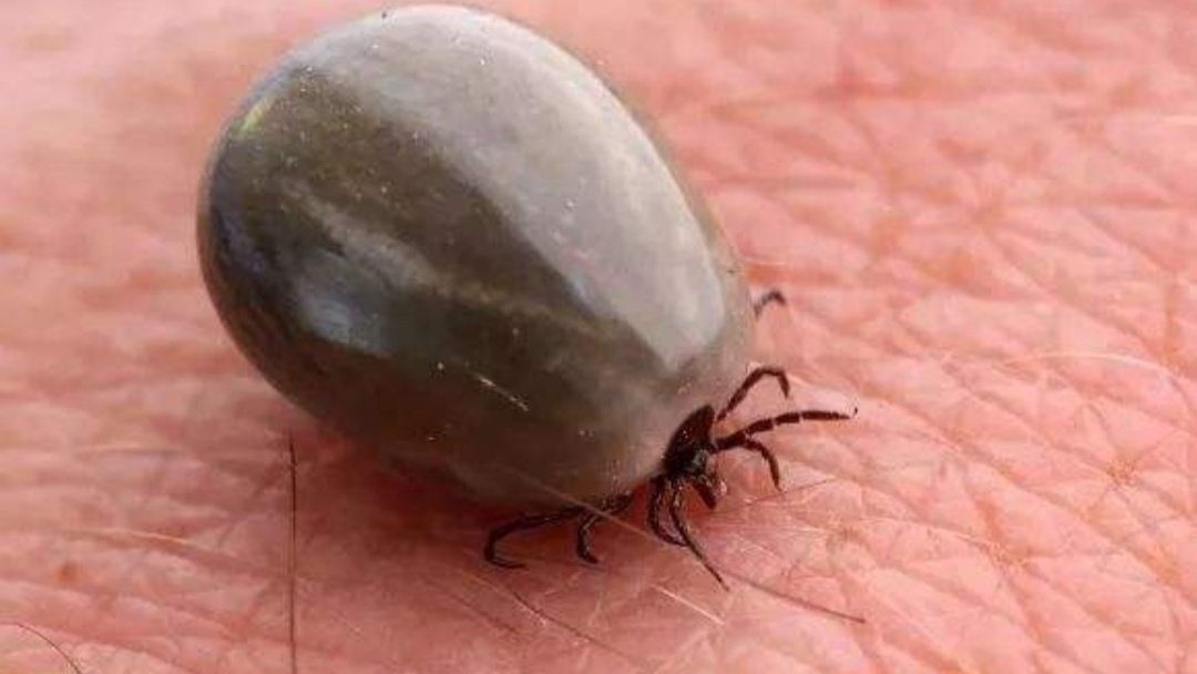 怎样知道自己被蜱虫叮咬上了？