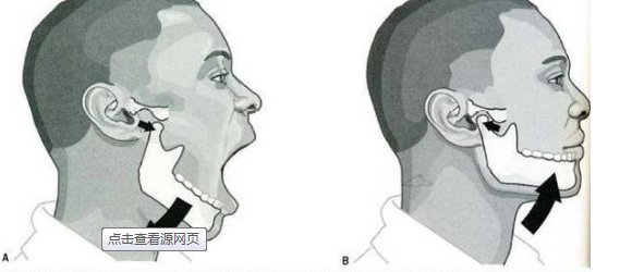 用什么方法可以让下巴变尖？