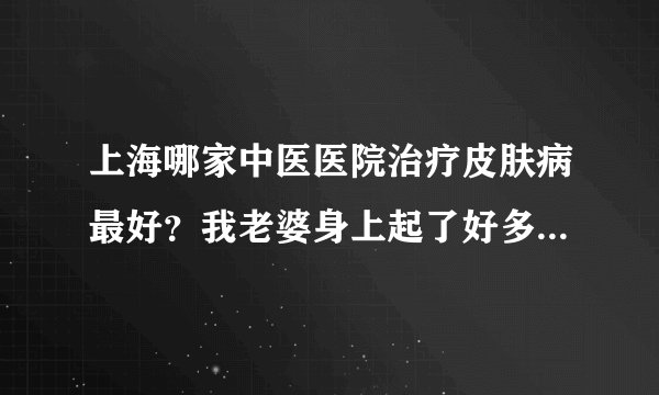 上海哪家中医医院治疗皮肤病最好？我老婆身上起了好多小疙瘩久治不愈。