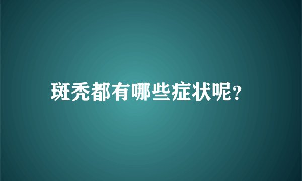 斑秃都有哪些症状呢？