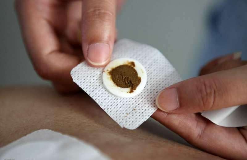 三伏贴真的是骗局吗?